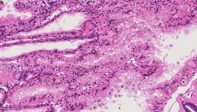 Figure 4. B) Lipofuscin granules (Black Asterix) in the nephrocytes. HES stained. NDP view 2, 40X (HAMAMATSU Photonics). 