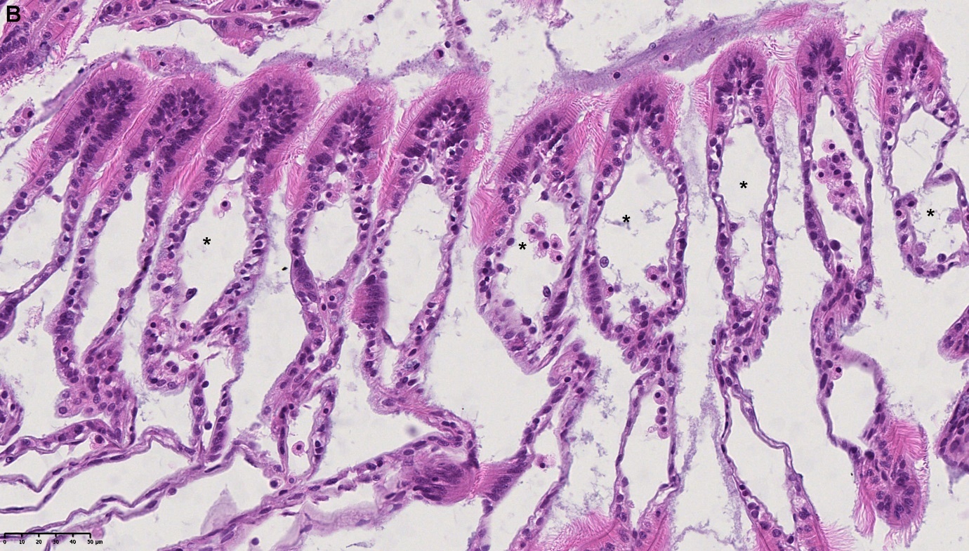 Figure 3.Gill. B) Enlargement of subepithelial space (*) with flow of hemocytes in the branchial space (black Asterix). NDP view 2, 40x (HAMATSU Photonics)